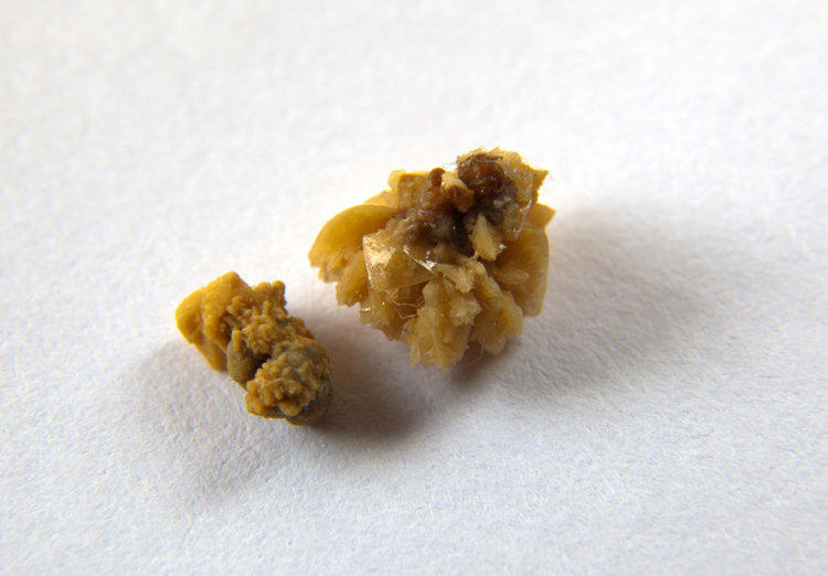 世界上最疼的病是什么病？疼痛排名前6的病，经历过的都是超人
