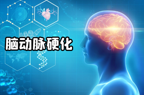 脑动脉硬化