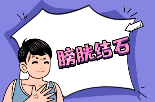 膀胱结石症状、病因、治疗一览