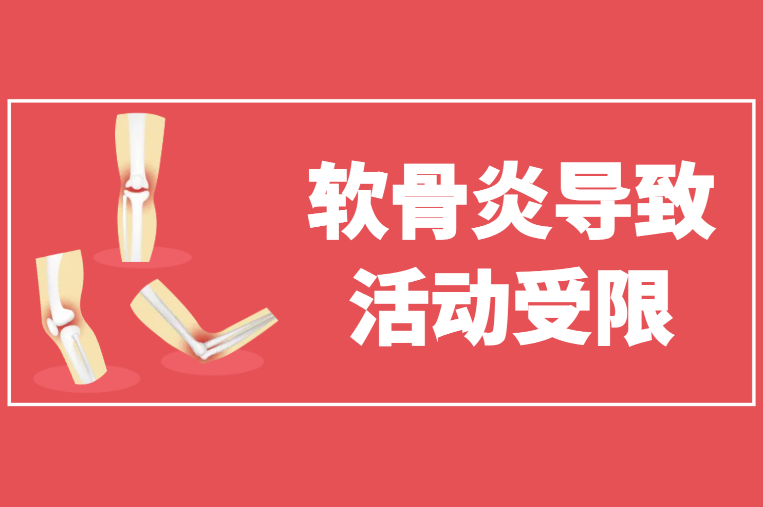 软骨炎 软骨炎