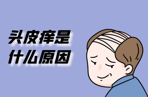 头皮痒是什么原因导致的？如何改善？
