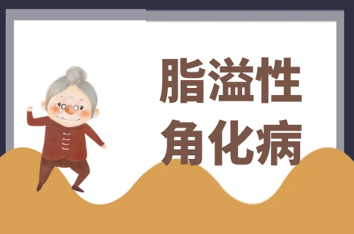 脂溢性角化病