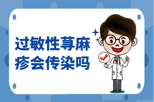 过敏性荨麻疹会传染吗 过敏性荨麻疹会传染吗
