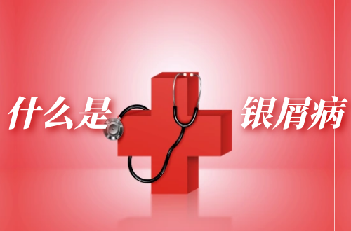 什么是银屑病？关于银屑病你了解多少？