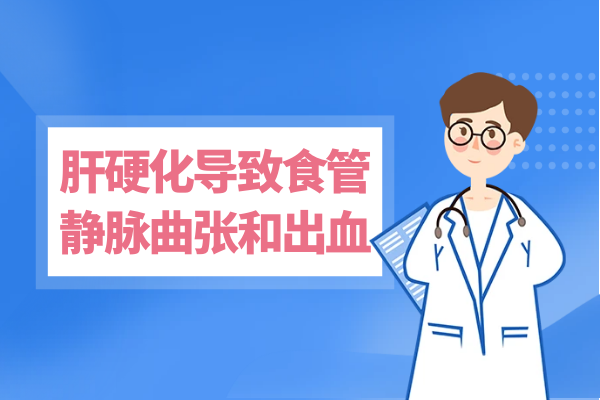 食管静脉曲张和出血 食管静脉曲张和出血