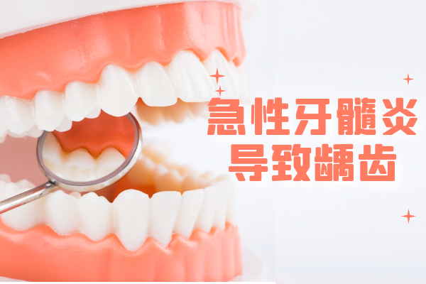 龋齿 龋齿