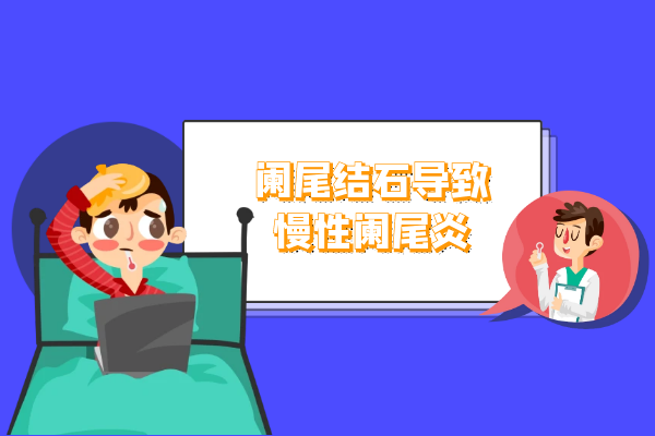 阑尾结石 阑尾结石
