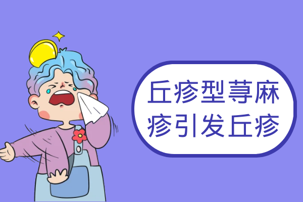 丘疹 丘疹