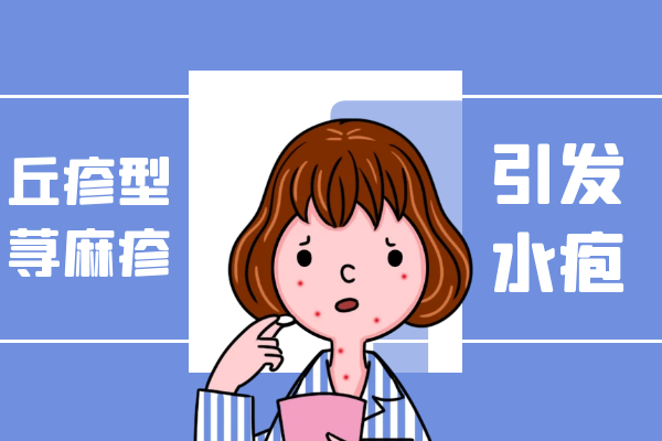 水疱 水疱